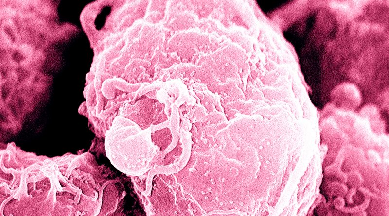 Al sistema inmune también le salen ‘arrugas’: ¿qué ocurre cuando nuestras defensas envejecen?