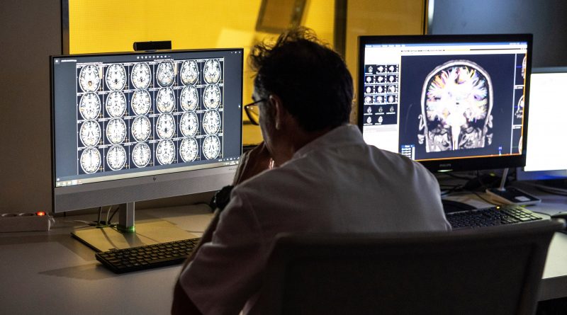 La gran revolución contra el alzhéimer: “Es la primera vez en la historia de la humanidad que conseguimos ralentizar la enfermedad” La gran revolución contra el alzhéimer: “Es la primera vez en la historia de la humanidad que conseguimos ralentizar la enfermedad”