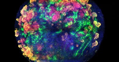 El primer trasplante de minirriñones humanos en cerdos abre una vía para no desperdiciar miles de órganos donados