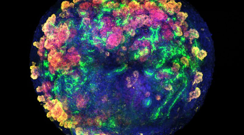 El primer trasplante de minirriñones humanos en cerdos abre una vía para no desperdiciar miles de órganos donados