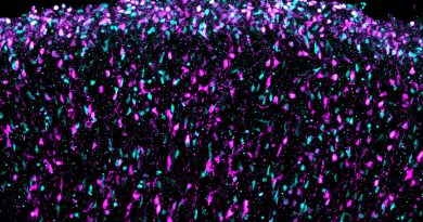 El primer mapa del cerebro en formación permite vislumbrar el origen de los trastornos de la mente