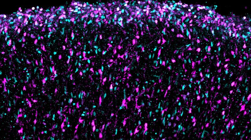 El primer mapa del cerebro en formación permite vislumbrar el origen de los trastornos de la mente