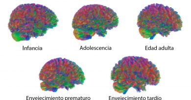 Las cinco ‘edades’ del cerebro humano: hay cambios cruciales alrededor de los 9, los 32, los 66 y los 83 años