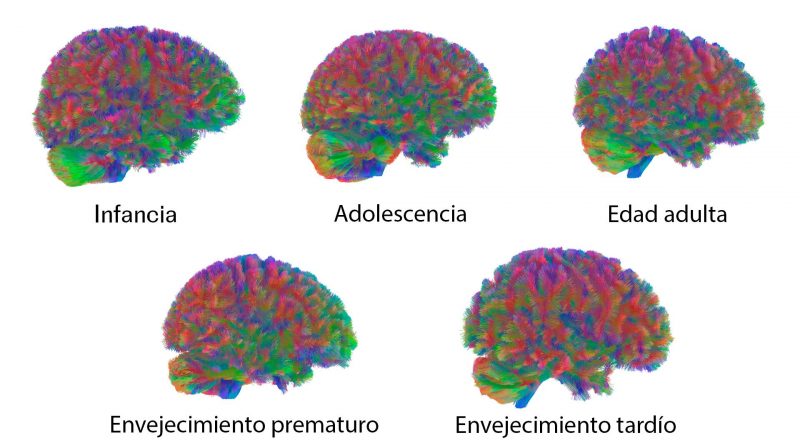 Las cinco ‘edades’ del cerebro humano: hay cambios cruciales alrededor de los 9, los 32, los 66 y los 83 años