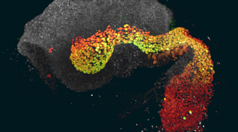 Un modelo de embrión reproduce por primera vez la semana más misteriosa de la formación de un ser humano Un modelo de embrión reproduce por primera vez la semana más misteriosa de la formación de un ser humano