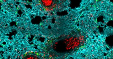 El mapa de los neutrófilos: crean una herramienta para combatir el cáncer o las infecciones con las células inmunes más abundantes