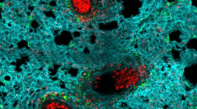 El mapa de los neutrófilos: crean una herramienta para combatir el cáncer o las infecciones con las células inmunes más abundantes El mapa de los neutrófilos: crean una herramienta para combatir el cáncer o las infecciones con las células inmunes más abundantes