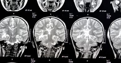 De Borges a Jennifer Aniston: la ciencia empieza a iluminar los misterios de la memoria