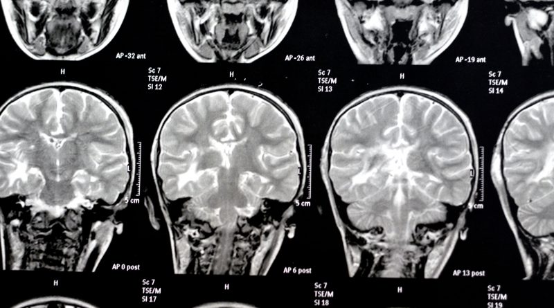 De Borges a Jennifer Aniston: la ciencia empieza a iluminar los misterios de la memoria