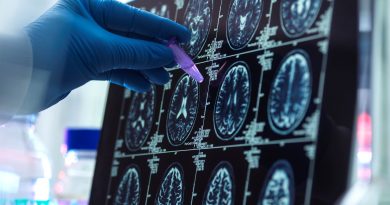 Un nuevo análisis permite detectar el alzhéimer a partir de un pinchazo en el dedo