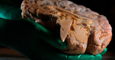 ¿Lo dejas todo para luego? Unos científicos japoneses han encontrado el motivo en el cerebro