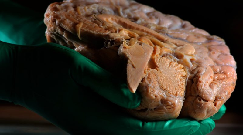 ¿Lo dejas todo para luego? Unos científicos japoneses han encontrado el motivo en el cerebro